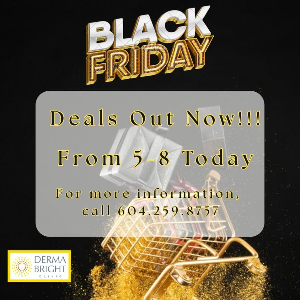 Black Friday Deals